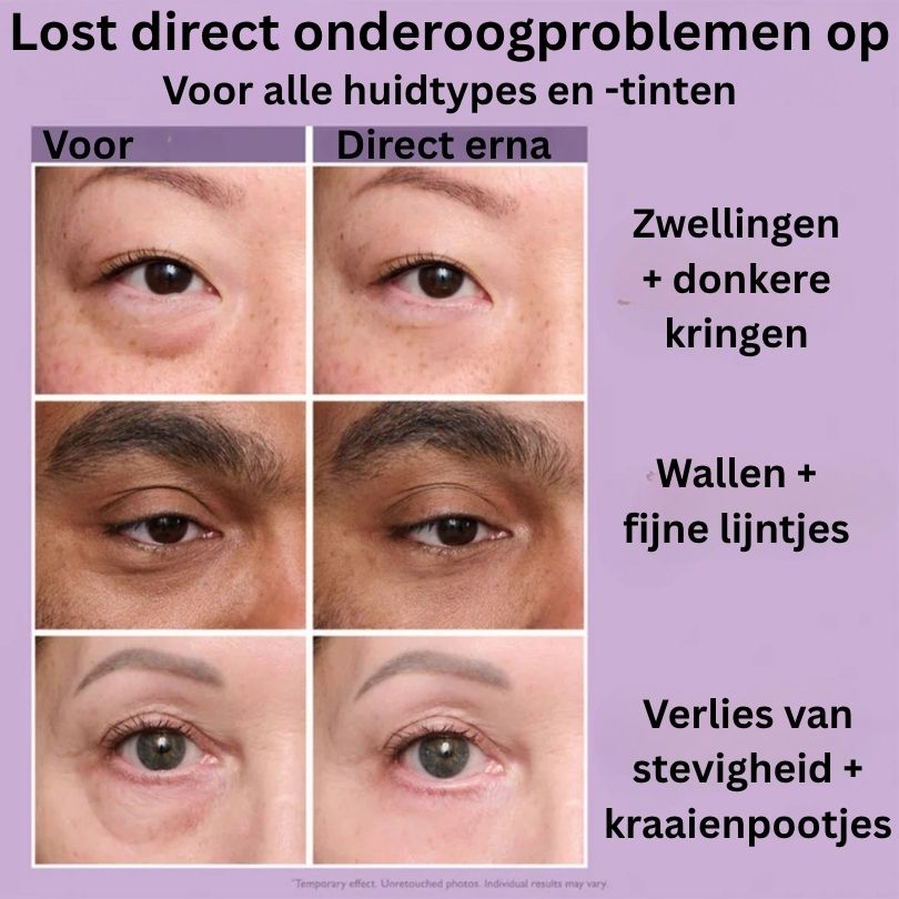 PETER Thomas Roth Instant eye tightener™ – Gemakkelijke Oogverstrakker voor Tijdelijke Stevigheid.